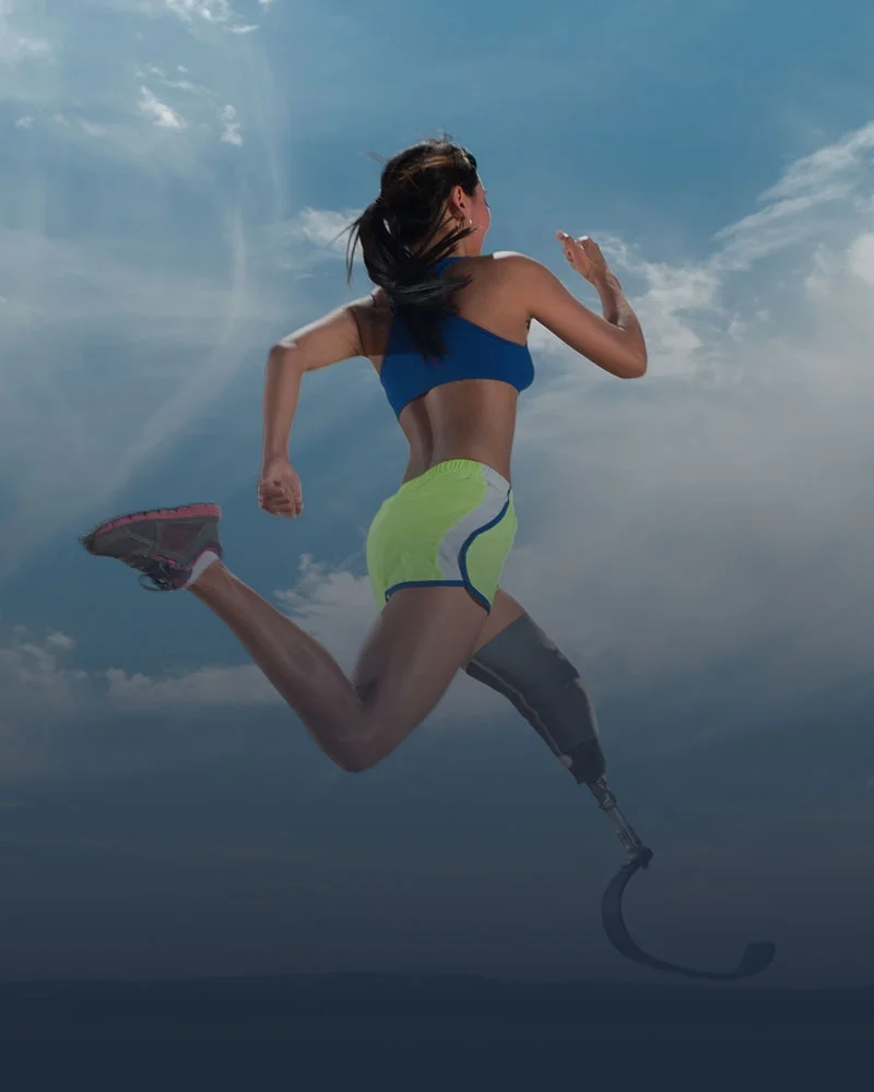 Lower Limb Prosthetics