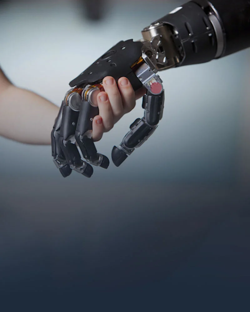 Upper Limb Prosthetics